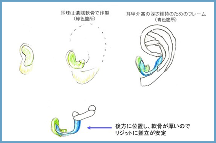 耳甲介窩（外耳道の入り口）の形成